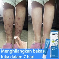 Scar Cream 10g Wound Healing Ointment Scar Remover Cream Reduce Scar Scar Treatment Scar Gel Remove 