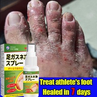 Foot spray Foot odor remover, foot deodorant spray, foot exfoliating spray Foot spray Herbal antifun