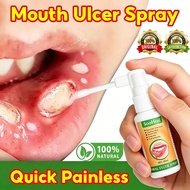 Mouth Ulcer Spray Ulcer Breath Sprays Mouth Ulcers Repair Spray Ulcer  Canker Sore Canker Spray