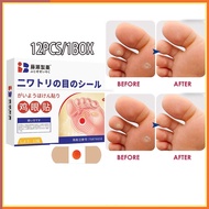 SG Japan Wart Removal Patch Corn Plaster 12pcs Foot Corn Remover Corn Painless Removal