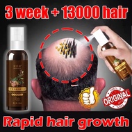 Hair growth serum Hair tonic for growth Hair loss tonic 100ml Hair Growth For Men And Women Anti Hai