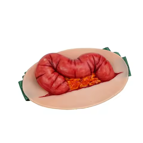 Ultrassist Wearable Abdominal Evisceration Intestinal Wound Simulator Open Abdominal Wound Packing f