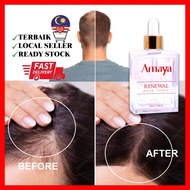 Ready Stock Amaya renewal hair tonic / Hair Tonic Growth / Scalp Care Hair Treatment 50ml Shiseido Rambut gugur