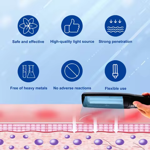 Original 311nm UVB Phototherapy For Vitiligo, UVB Lamp,Eczema, Psoriasis Skin Disease Treatment Lamp