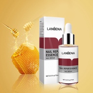 LANBENA เซรั่มเล็บ เล็บขบ เชื้อรา 15ml (แถมฟรี!! ตะไบเล็บ) Nail Repair Essence Serum