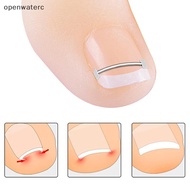 [openwaterc] Ingrown Toenail Correction Tool Toenail Recovery Ingrown Toenail vn