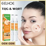 EELHOE Tag &amp; Warts Remover Liquid Antibacterial Ointment Wart Treatment Cream Skin Tag Remover Herbal Extract 3ml