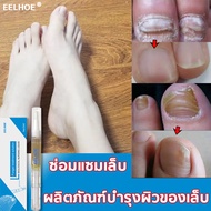 ของแท้100% ยาเชื้อราเล็บ nail fungus เซรั่มซ่อมแซมเล็บ ซ่อมแซมเล็บเสีย กำจัดเล็บเสีย ส่งเสริมการเจริ