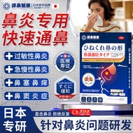 日本泽桑制药 鼻炎贴专用过敏性鼻炎鼻窦炎贴药成人儿童季节急慢性鼻子堵塞不通气穴位压力刺激贴 鼻炎专用贴