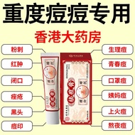 【Official Authentic Product】Acne removal cream repairs and f【官方正品】祛痘膏修复淡化痘印祛痘淡化痘坑学生4.7