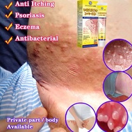 japanese anti itch cream Psoriasis Ointments Eczema mosquito bite relief relieve Rash Cream redness 