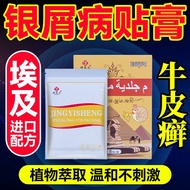 Cowhide Cowhide Moss Silver Chips Disease Patch Cream Skin Itching Flower Spots Eczema Anti-Itching 