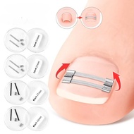 1 set 2Size Ingrown Toenail Corrector Clips Brace Tools Pedicure Recover Embed Toes Nail Treatment P