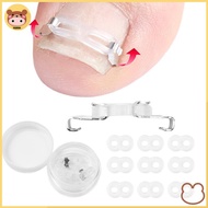 aosun 1/2 Set Ingrown Toenail Corrector Tools Pedicure Recover Embed Toenail Treatment Foot Care Cor