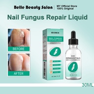 OUHOENail Fungus Repair Essence Onychomycosis Removal Anti-fungal Nail Fungal Foot Nail Care