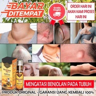 bahira oil obat benjolan payudara - benjolan minyak qahira Diskon