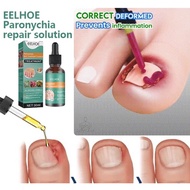 EELHOE Paronychia repair solution/Nail repair solution/Nail Fungus Treatment