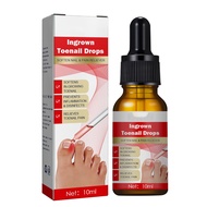 Ingrowth Toenail Correction Oil Ingrown Toenail Drops Nail Care for Ingrown Toenails