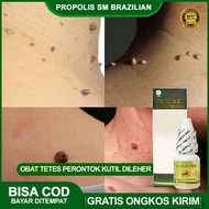 Obat Tetes Perontok Kutil Penghilang Kutil Di Leher Kutil Papiloma Skin Tag Penghilang Daging Tumbuh