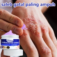 Krim Antibakteria Ubat Gatal Kemaluan Krim Gatal Ekzema Gatal Psoriasis Krim AntibakteriaAntibacteri