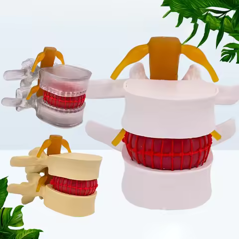Profession Lumbar Model Human Anatomy Skeleton Spine Lumbar Disc Herniation Teaching Model Demonstra