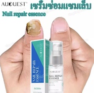 AuQuest เซรั่มทาเล็บ เชื้อราเล็บมือ 20ml ยาทาเชื้อราที่เล็บ ทาเล็บ น้ำยาทาเล็บ น้ำมันทาเล็บ ทาเชื้อร