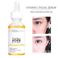 SKIN EVER Vitamin C Whitening Facial Serum Essence Moisturizing Facial Treatment 30ml