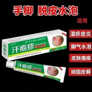 2026新品汗疱疹汗疱疹手部脚上起小水泡止痒脱皮真菌感染膏夏季Dyshidrotic eczema: Small blisters on the hands and feet—relief.jh500