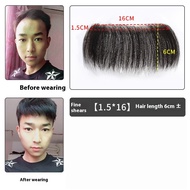 วิกผมผมปลอมผู้ชายส่วนหน้าสำหรับผู้ชาย6ชิ้นเทปฟรีหน้าผากหัวผมปลอมมนุษย์สำหรับศีรษะล้านผมสำหรับต่อ Rem