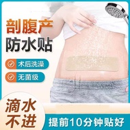 2025 New Style Medical Waterproof Sticker Swimming Sticker Private Protection Caesarean Section Woun