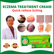 👍 100% ORIGINAL &amp; Effective Eczema Treatment herbal antibacterial cream 20g Safe and no side effects, effective in one day, psoriasis, gamot sa buni, ointment for itchy skin and allergy, dermovate, ringworm removal, fungisol antifungal 👍