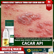Obat Cacar Api Dewasa Cacar Api Bayi Cacar Api Anak Herbal Cacar Api Bekas Cacar Api Cacar Ular Bint