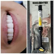 Composite dentex veneer