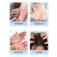 [Ready Stock] Toxic Cleaner Spray Soothes Itchy Scalp Itchy Scalp Itchy Floral Skin Discomfortable S