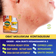 Obat Moluskum Kontagiosum atau Bintil Bintik Kecil Di Kulit Bentol Merah Diseluruh Tubuh Seperti Waj