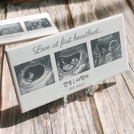 Baby Ultrascan Personalised  Frame | ultrasound Frame New Daddy,Personalised Pregnancy Announcement 
