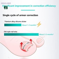 [GrandLarge] 2Pcs Ingrown Toenail Corrector Tools Pedicure Recover Embed Toe Nail Professional Ingro