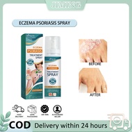 Eczema Psoriasis Spray 100ml Treatment eczema tinea psoriasis relief from itching.
