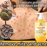 Acne body wash eczema body wash 500ml eczema/antifungal Acne and mite removing sulfur Deep cleansing