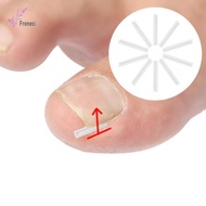 [freneci] 10x Ingrown Toenail Corrector Strips Curved Toenail Corrector Treatment Men