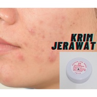 Acne Krim Jerawat Acne Scar Parut Blackhead Skincare for pimple Skincare