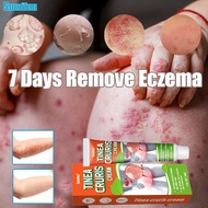 ubat gatal kemaluan ubat celah kangkang gatal Private parts Antifungal cream anti-itching cream Ecze