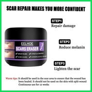 ۩ ◙ EELHOE Original Scar Repair Cream for old scar stretch mark remover acne scar remover Aliver sc