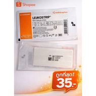 Steri-Strip Wound Dressing Closure Instead Of Sewing Reduce The Chance Of Raised Scars