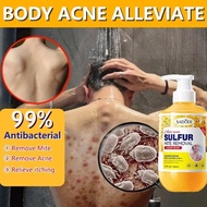 Sulfur anti mite shower gel, anti mite itching shower gel/anti itch/mite/oil control/antibacterial s