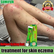 【Super Effective】Skin antipruritic eczema cream natural Chinese herbal medicine ECZEMA CREAM