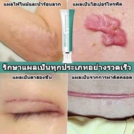 breylee ของแท้ ครีมลดแผลเป็น ครีมลบแผลเป็น scar removal cream ยาทาแผลคีลอยด์ ครีมทาแผลผ่าคลอด  ลบลอยแผลเป็น ลดแผลไฟไหม้ แผลน้ำร้อนลวก ครีมทาแผลผ่าตัด