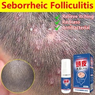 Scalp Treatment Anti Dandruff Ubat Kulit Kepala Berkuping Scalp Psoriasis Itchy Scalp Seborrheic Der