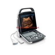 High Quality Medical Ultrasound Machine Mindray DP-20 Potable Digital Ultrasound Device for Abdomen,