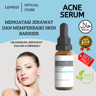 ACNE SERUM - Serum acne penghilang jerawat bekas jerawat flek hitam BPOM scarlett wardah hanasui wajah glowing / serum acne